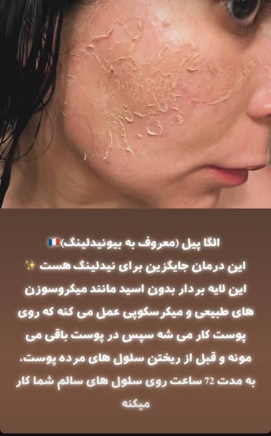خدمات تخصصی فیشیال و پاکسازی پوست آزیتا زارع در صفاییه یزد