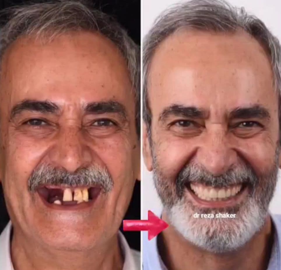 مرکز تخصصی ایمپلنت دکتر شاکر در سعادت آباد تهران