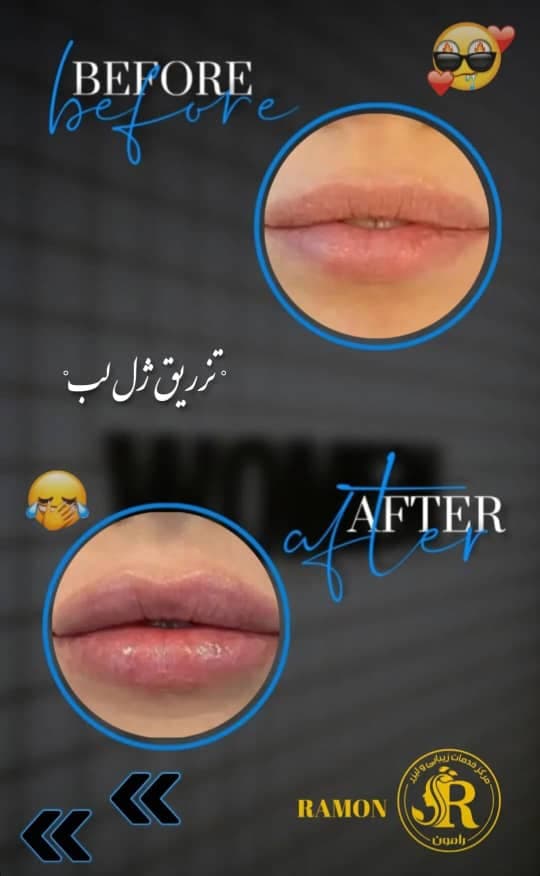 مطب تخصصی خدمات پوست و مو رامون در فرخشهر