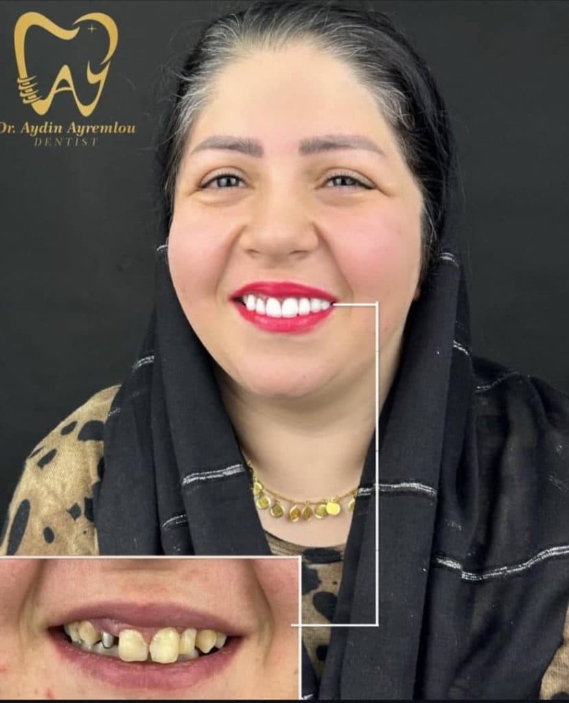 مطب دندانپزشکی دکتر آیدین آیرملو در تبریز