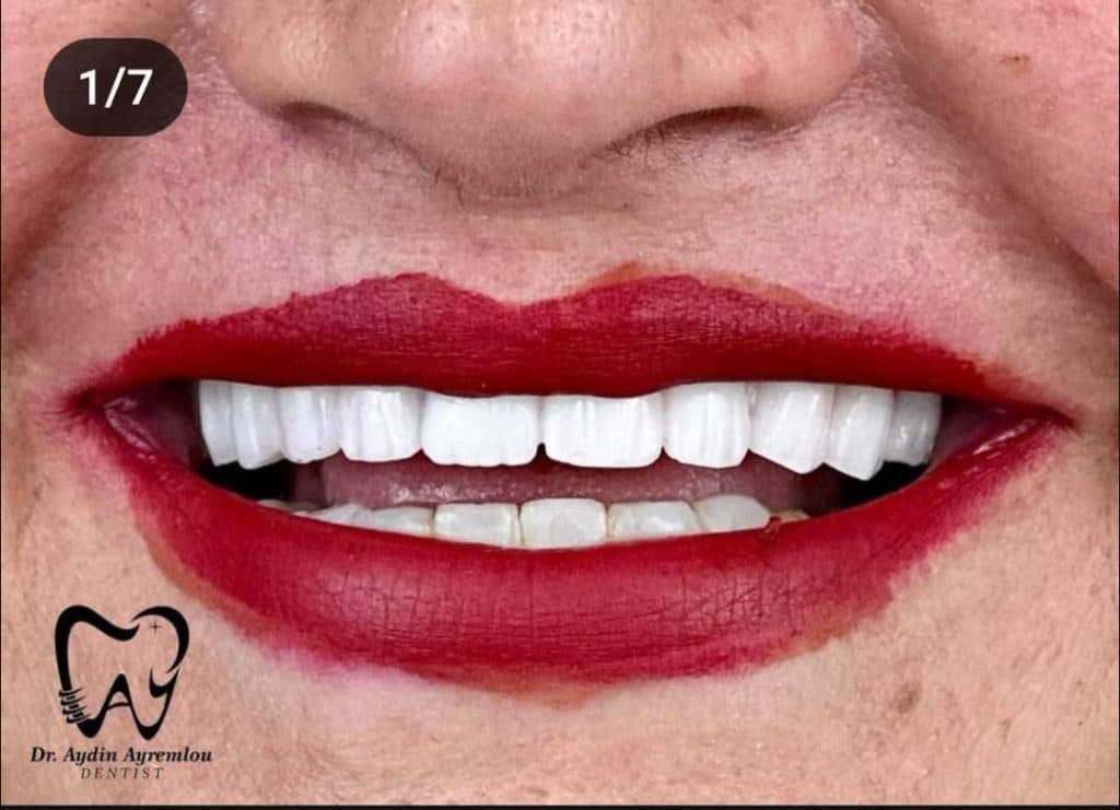 مطب دندانپزشکی دکتر آیدین آیرملو در تبریز