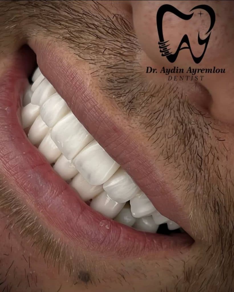 مطب دندانپزشکی دکتر آیدین آیرملو در تبریز