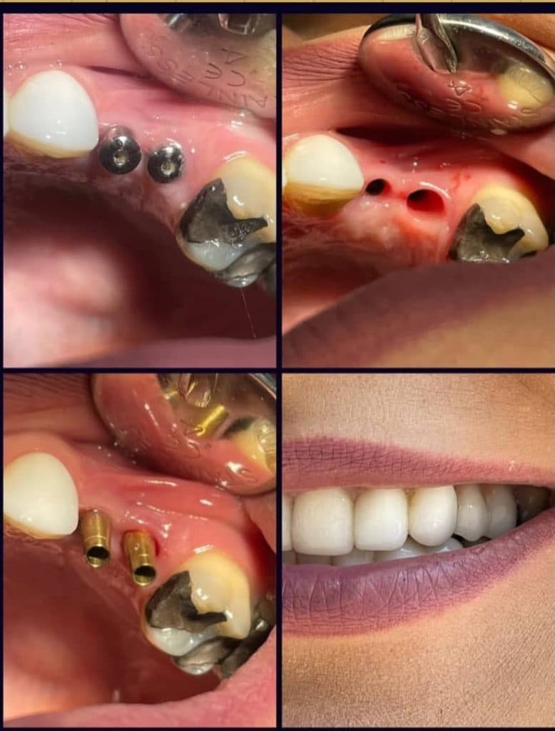 مطب دندانپزشکی دکتر آیدین آیرملو در تبریز