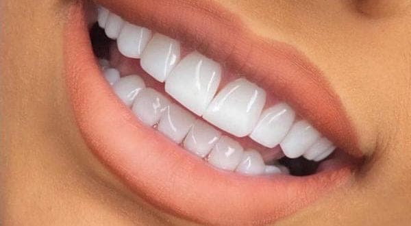 کلینیک زیبایی آلفا دنت در سنندج