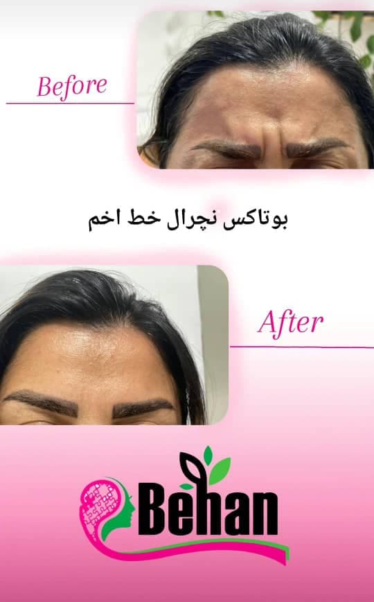 کلینیک تخصصی زیبایی لاغری بهان در آمل