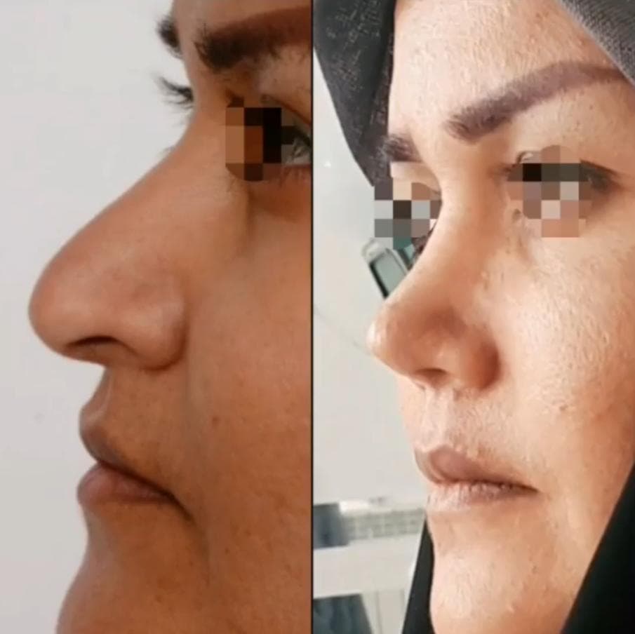 مطب زیبایی دکتر بابویی در منتظری بندر ماهشهر
