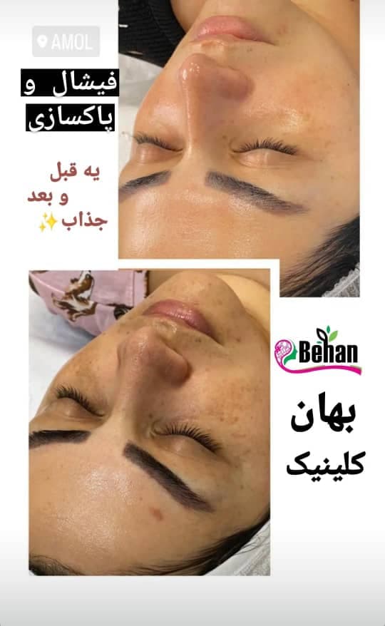 کلینیک تخصصی زیبایی لاغری بهان در آمل