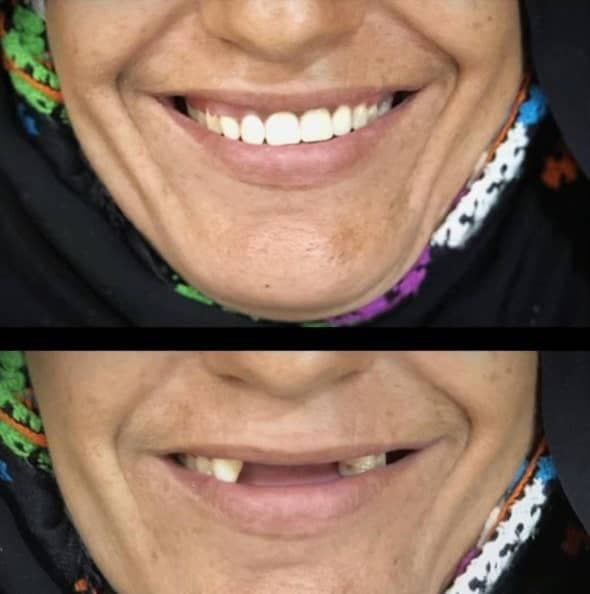 دندانسازی شکوهی یزد