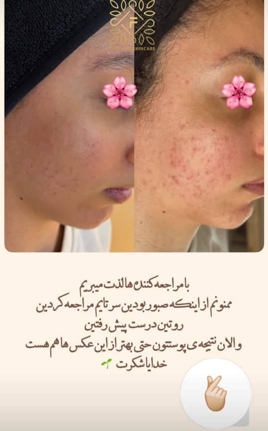 مرکز آموزش خدمات پاکسازی مراقبت از پوست و مو فیس تایم سارا محمدی در اصفهان