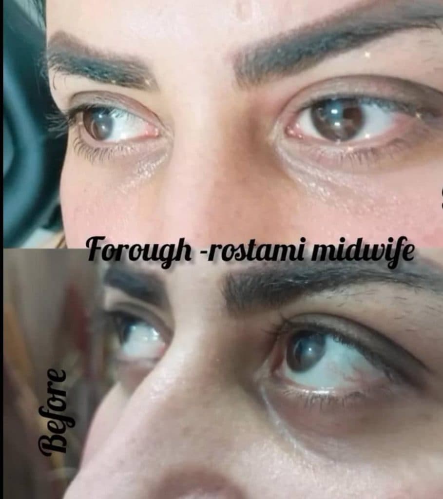 مرکز زیبایی بوتاکس و ژل درنیکا در بوشهر