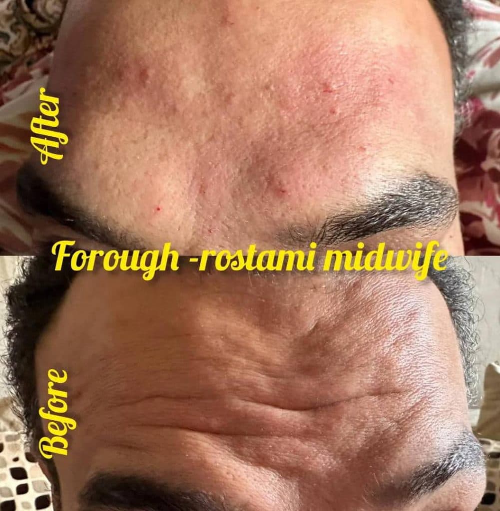 مرکز زیبایی بوتاکس و ژل درنیکا در بوشهر