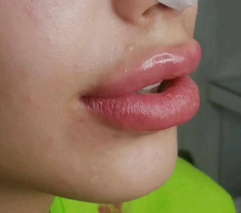 کلینیک زیبایی ویلانژ در ماهشهر