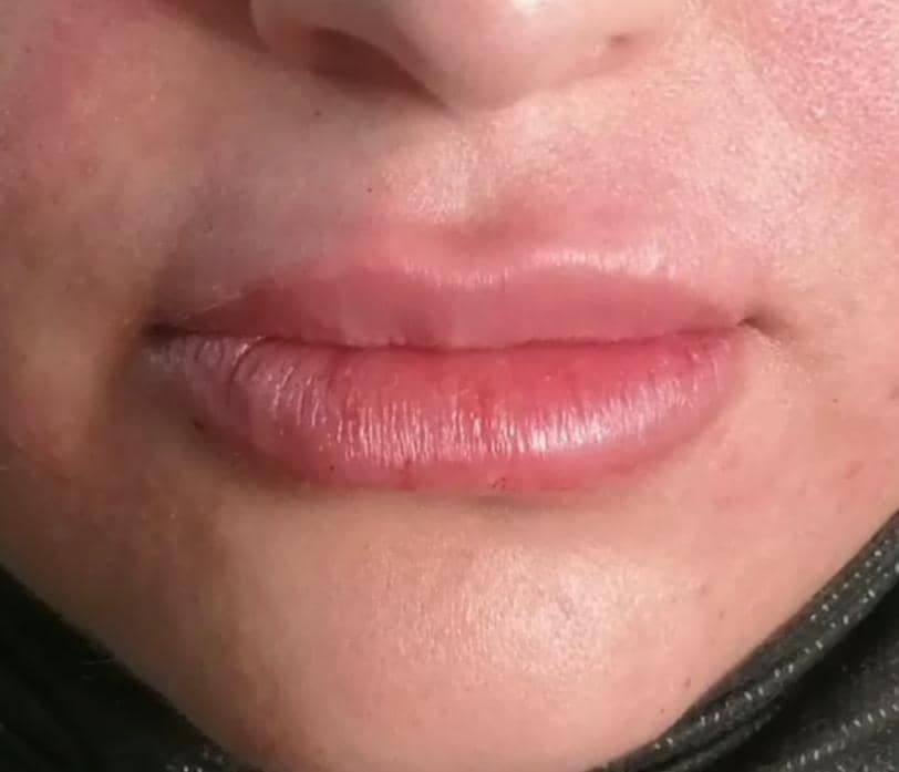 کلینیک زیبایی ویلانژ در ماهشهر