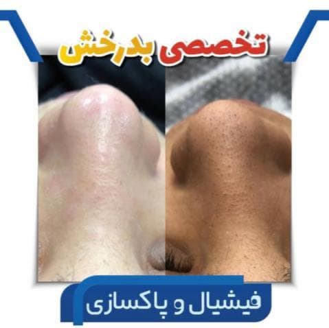 کلینیک زیبایی جوانسازی موراشین در بلوار فردوس تهران