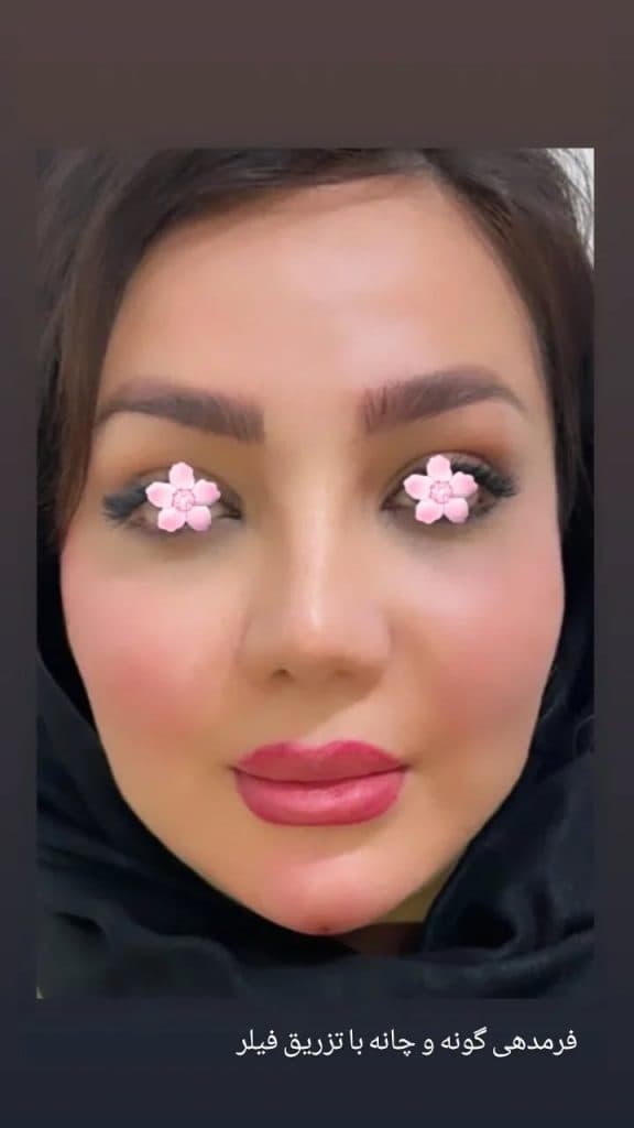 کلینیک زیبایی یاس در خرم آباد