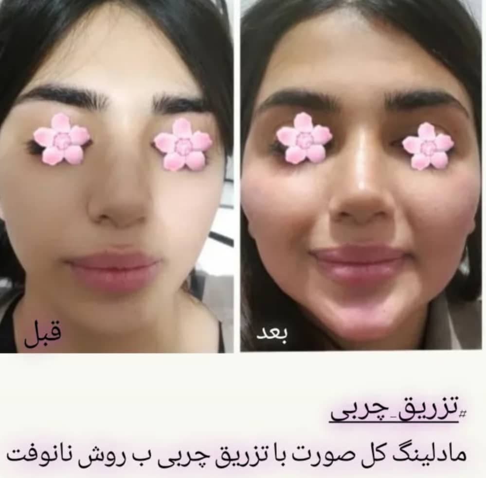 کلینیک زیبایی یاس در خرم آباد