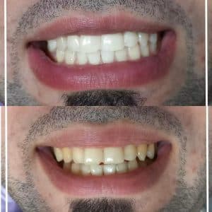 دندانپزشکی دکتر سید جعفر عزیزی در رشت