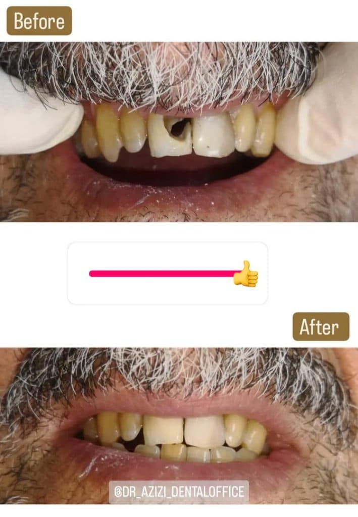 دندانپزشکی دکتر سید جعفر عزیزی در رشت