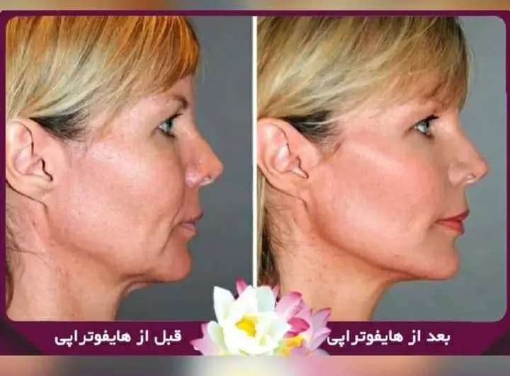 کلینیک تخصصی مزونیدلینگ صدف در کرج