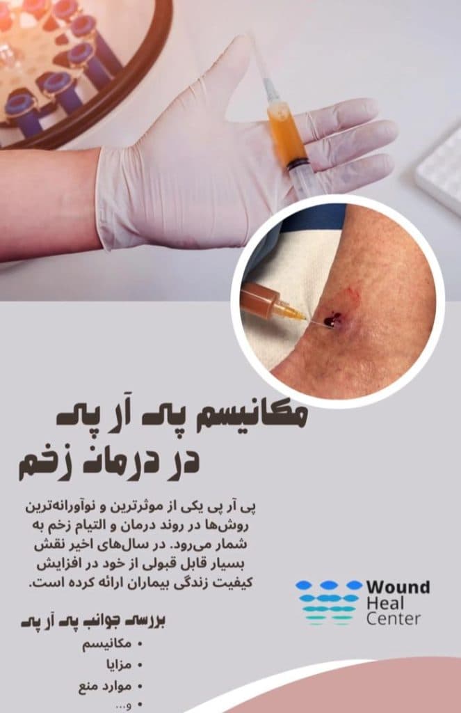 مرکز تخصصی مراقبت از زخم دیابت آقای پانسمان در اراک