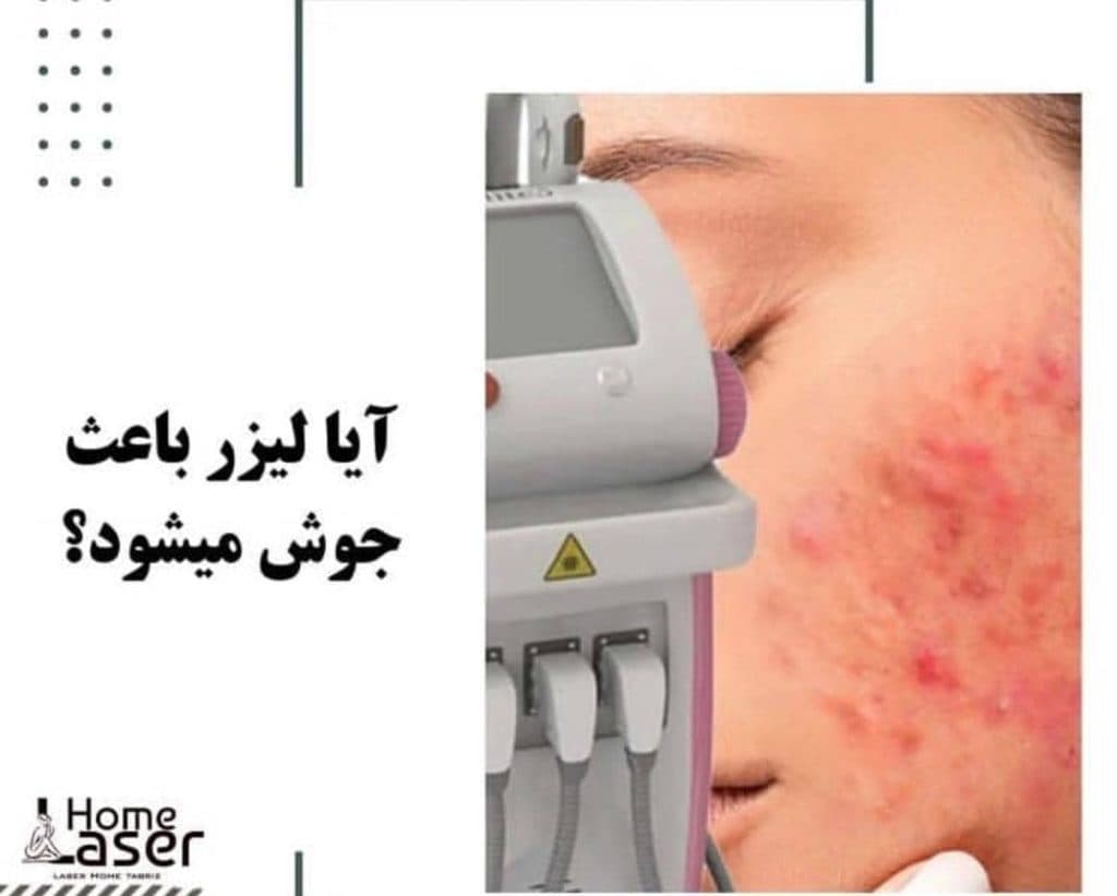 مرکز تخصصی زیبایی لیزر رویا در آبرسان تبریز