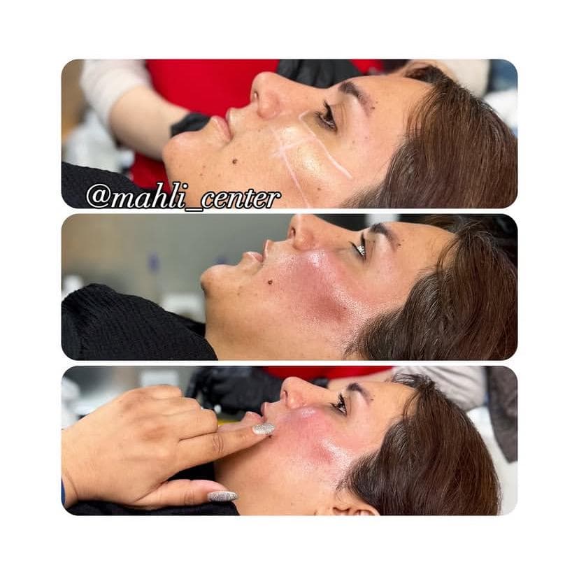 خدمات زیبایی ماهلی در نواب رشت