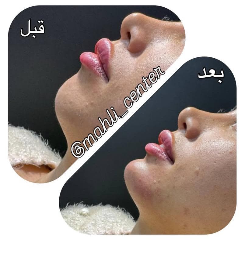 خدمات زیبایی ماهلی در نواب رشت