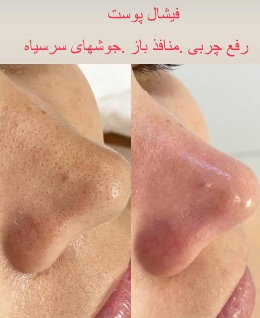 سالن زیبایی میدیا در مهاباد