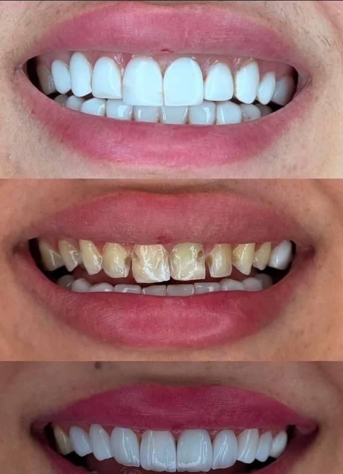 دندانپزشکی و خدمات کامپوزیت شبانه روزی صدف تهرانپارس تهران