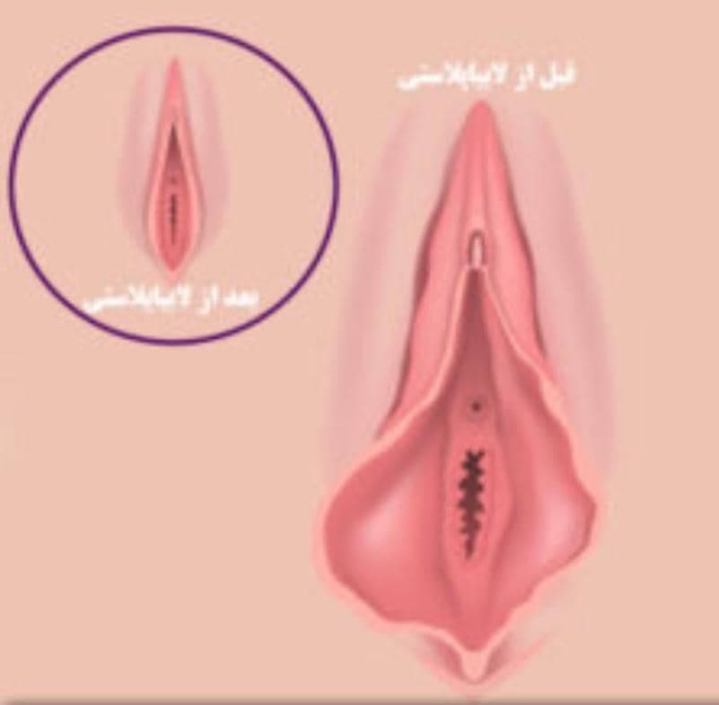 نوبت اینترنتی مرکز لابیاپلاستی بهاروند خرم آباد