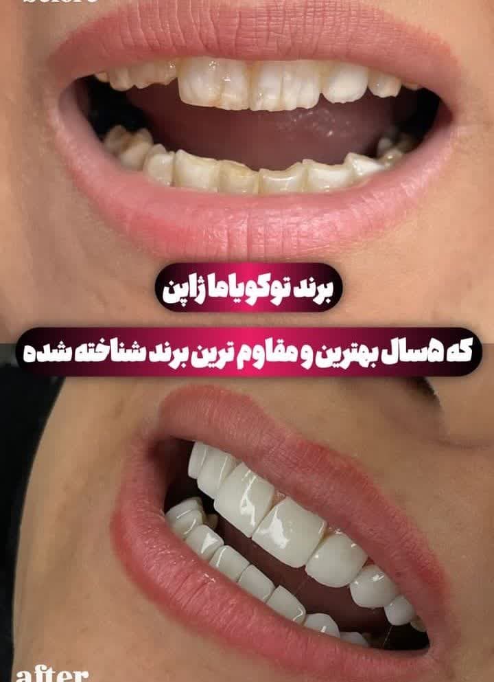 دندانپزشکی و خدمات کامپوزیت شبانه روزی صدف تهرانپارس تهران