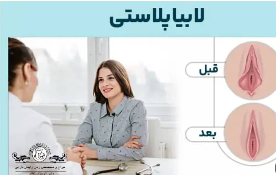 مرکز تخصصی لابیاپلاستی با لیزر رویش خرم آباد