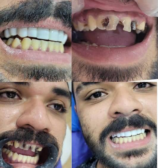 دندانپزشکی و خدمات کامپوزیت شبانه روزی صدف تهرانپارس تهران