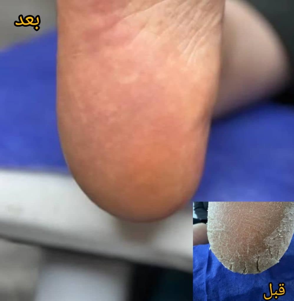 خدمات پدیکور درمانی مینا در رفسنجان
