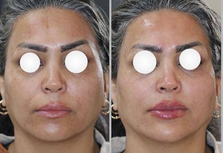 کلینیک زیبایی الی فیس به مدیریت الهام بابازاده در تهران