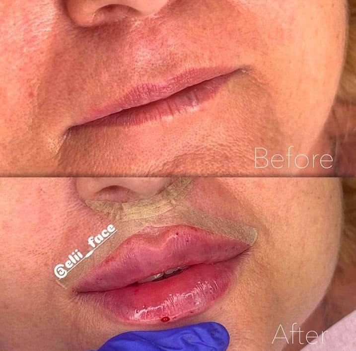 کلینیک زیبایی الی فیس به مدیریت الهام بابازاده در تهران