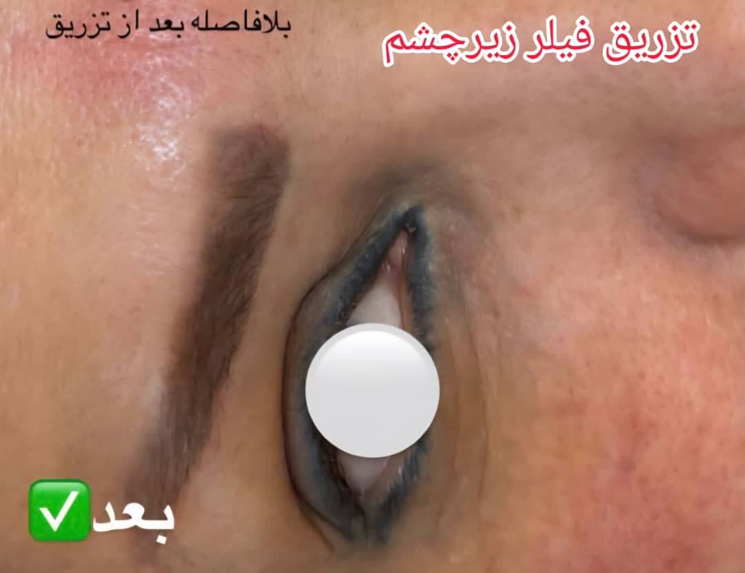 کلینیک زیبایی الی فیس به مدیریت الهام بابازاده در تهران