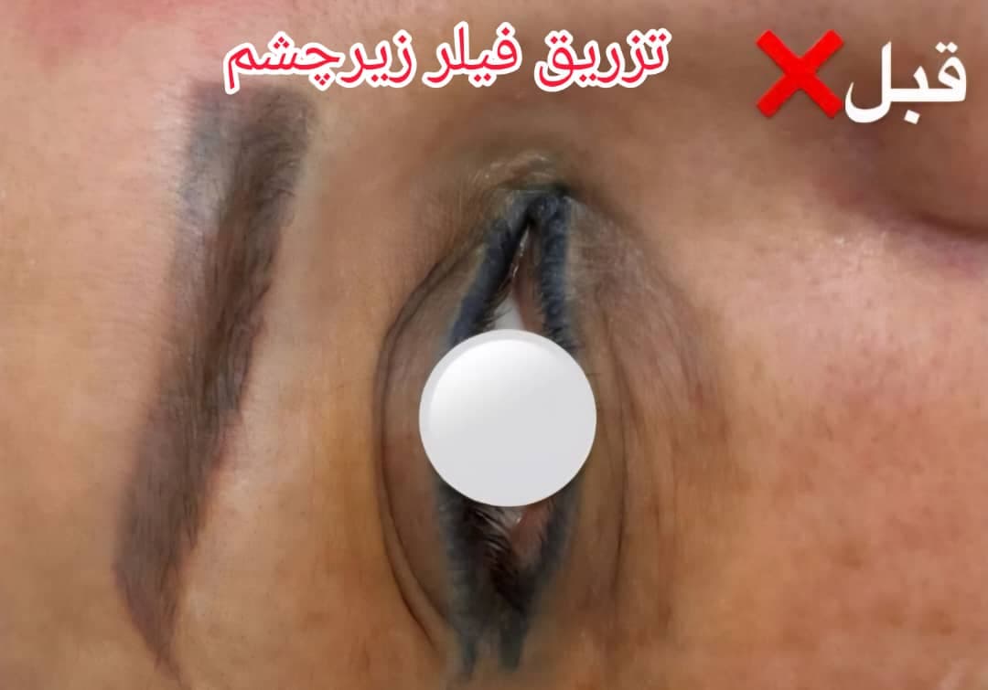 کلینیک زیبایی الی فیس به مدیریت الهام بابازاده در تهران