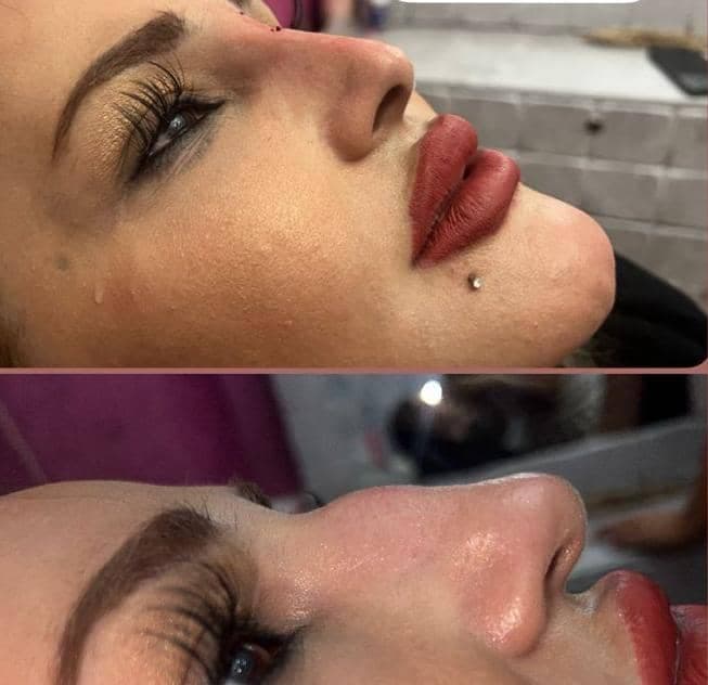 کلینیک زیبایی الی فیس به مدیریت الهام بابازاده در تهران