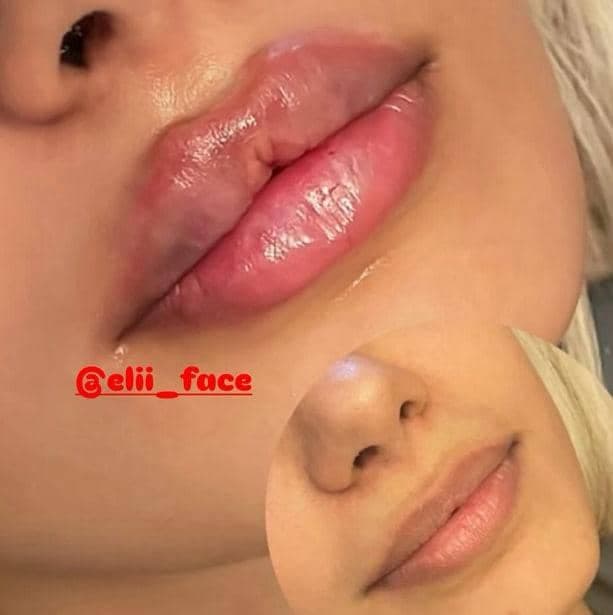 کلینیک زیبایی الی فیس به مدیریت الهام بابازاده در تهران