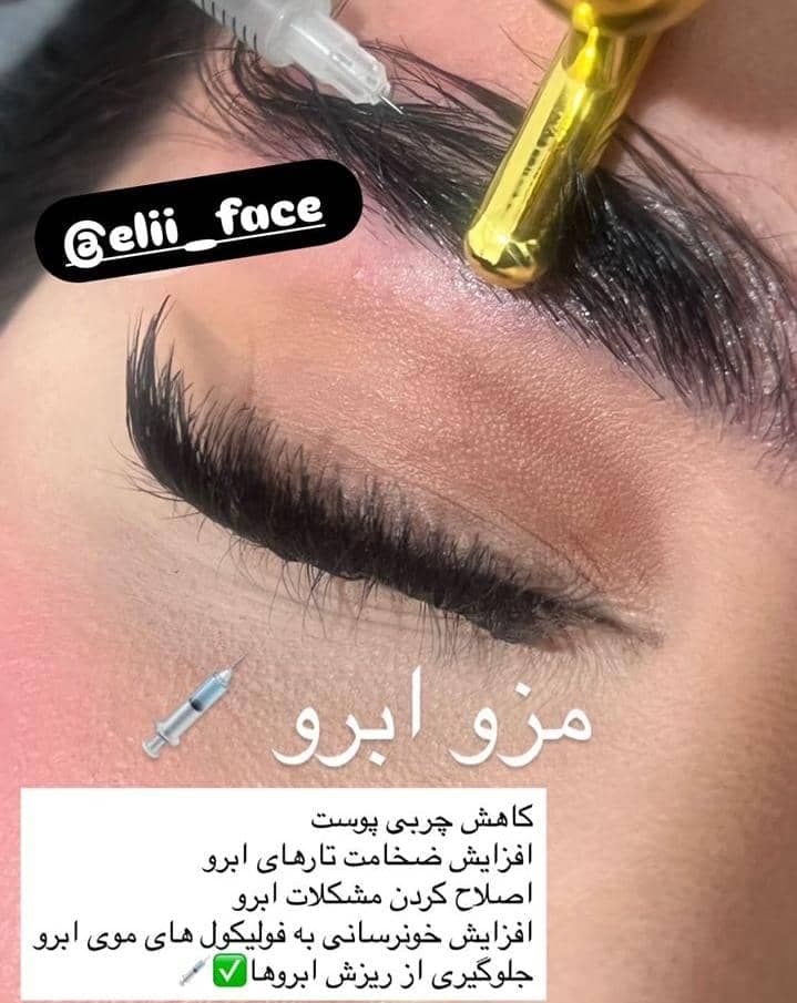 کلینیک زیبایی الی فیس به مدیریت الهام بابازاده در تهران