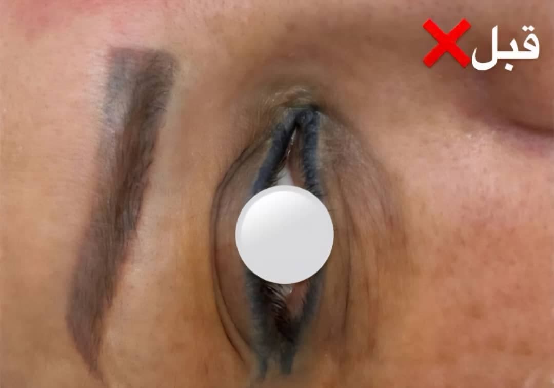 کلینیک زیبایی الی فیس به مدیریت الهام بابازاده در تهران