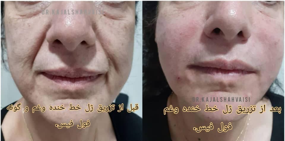 مطب زیبایی پوست و مو دکتر کژال شاه ویسی در سنندج