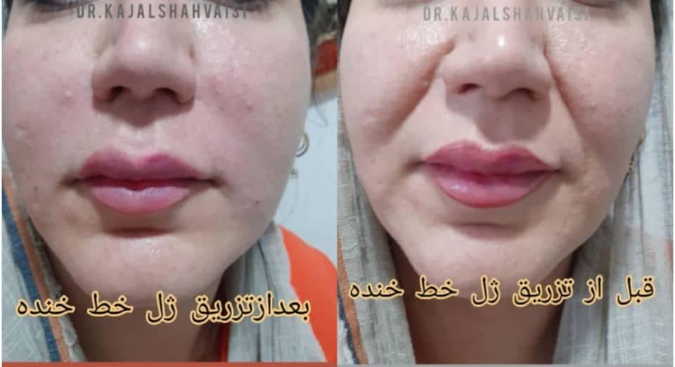 مطب زیبایی پوست و مو دکتر کژال شاه ویسی در سنندج