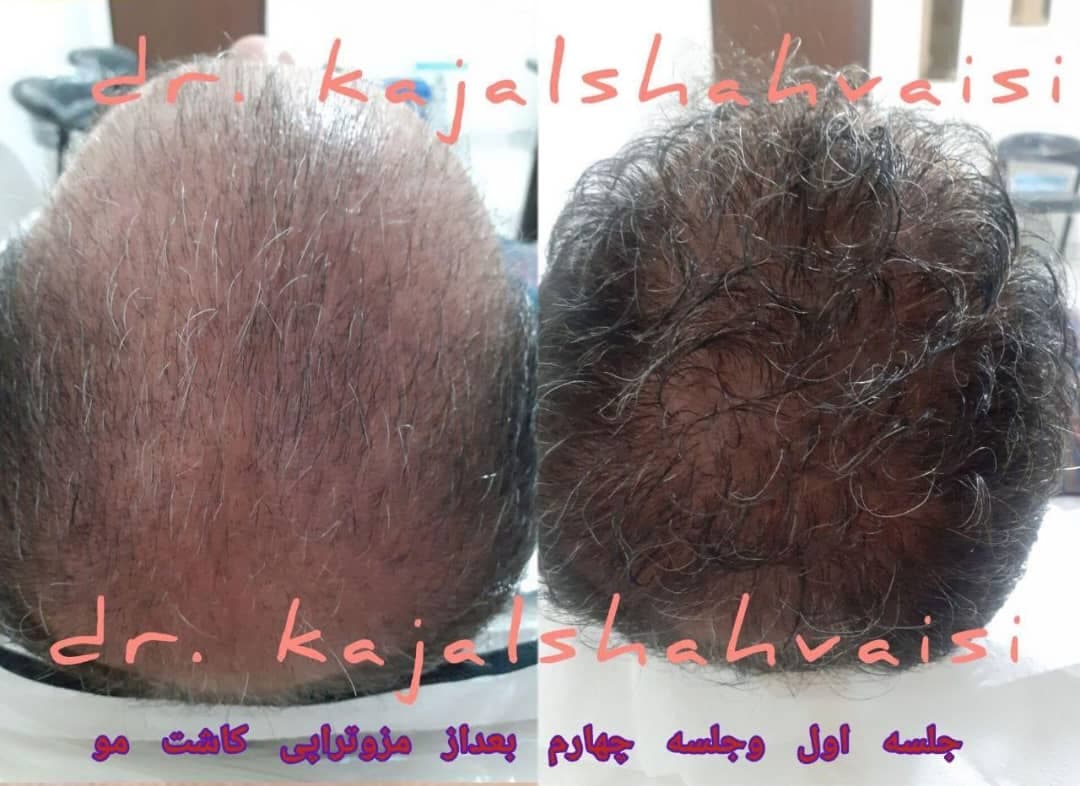 مطب زیبایی پوست و مو دکتر کژال شاه ویسی در سنندج