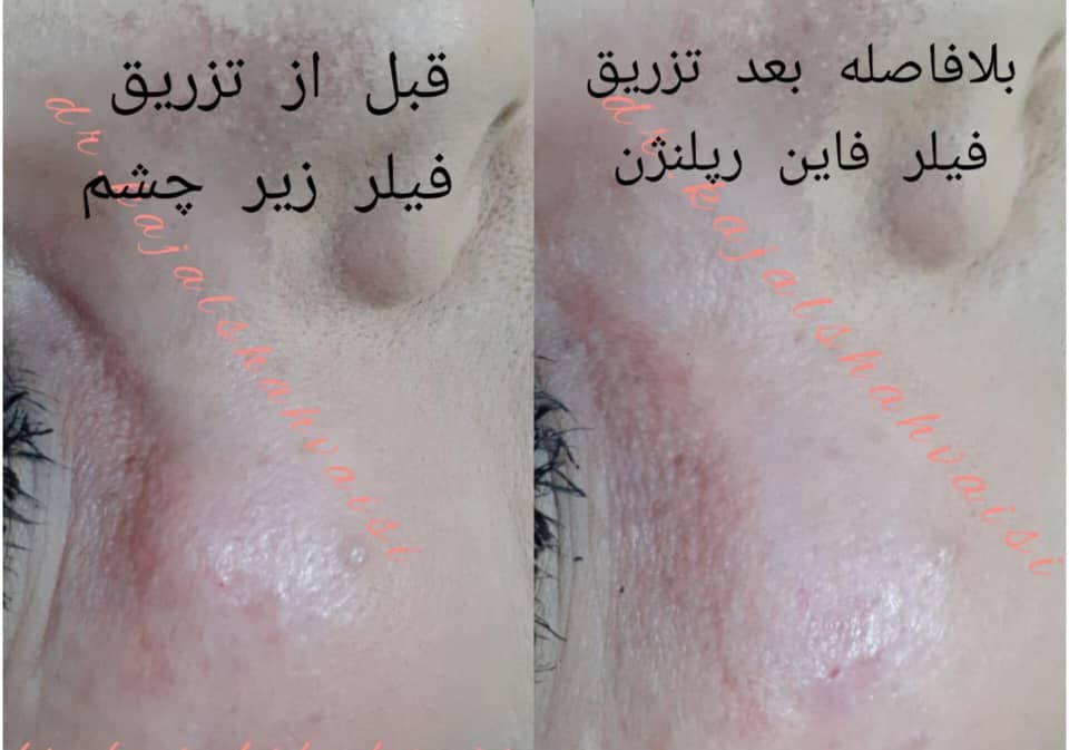 مطب زیبایی پوست و مو دکتر کژال شاه ویسی در سنندج