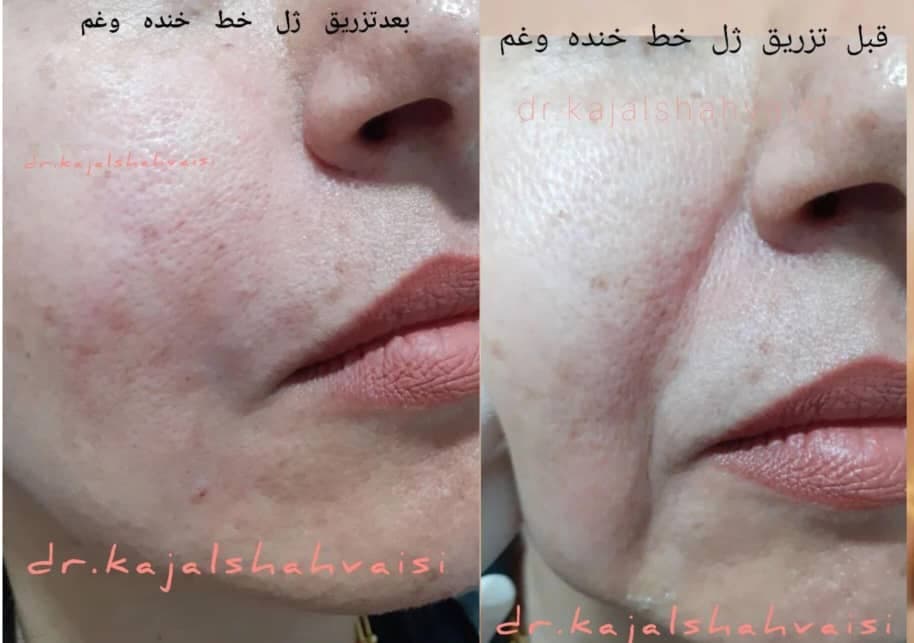 مطب زیبایی پوست و مو دکتر کژال شاه ویسی در سنندج