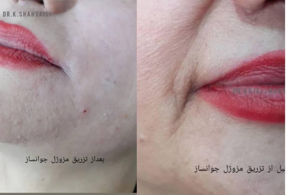 مطب زیبایی پوست و مو دکتر کژال شاه ویسی در سنندج