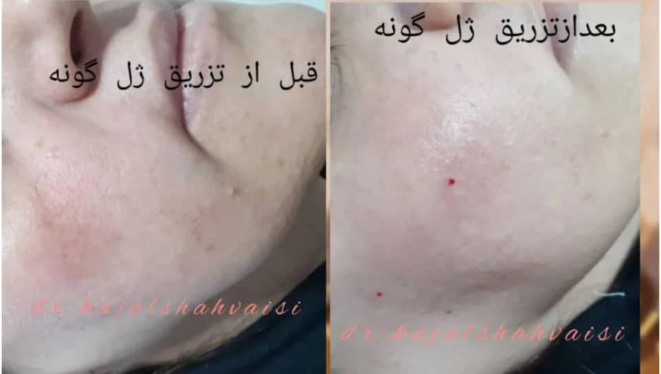 مطب زیبایی پوست و مو دکتر کژال شاه ویسی در سنندج
