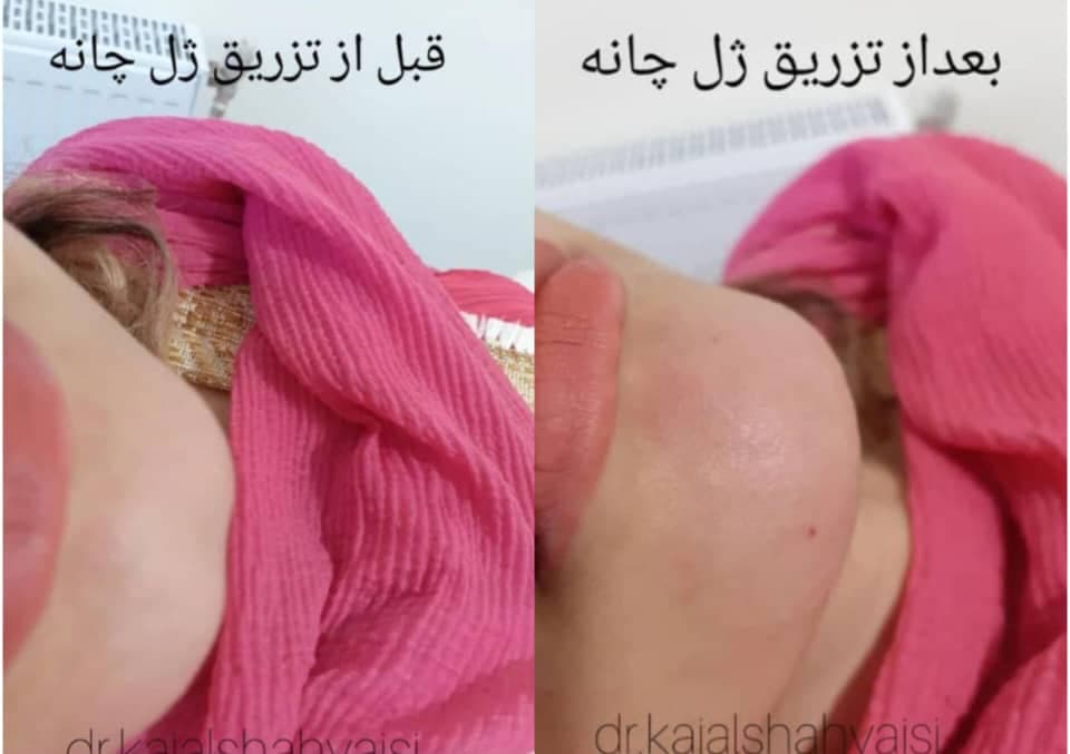 مطب زیبایی پوست و مو دکتر کژال شاه ویسی در سنندج